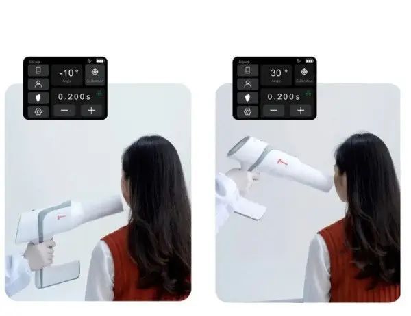 Woodpecker Ai Ray и i-Sensor H2 &ndash; портативный стоматологический рентген-комплект Ai Ray + H2 фото
