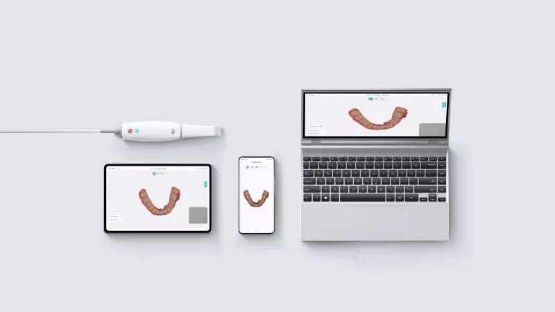 Smile Scan KP &mdash; інтраоральний стоматологічний сканер WDP008300 фото