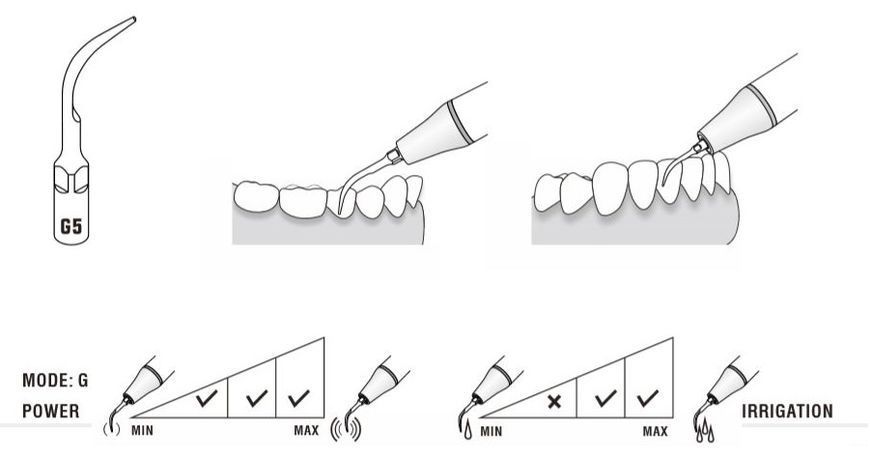 Насадка GD5 для скалера DTE GD5 фото